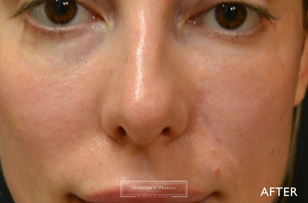 San Diego mohs surgery | La Jolla mohs surgery | Carmel Valley mohs surgery | Del Mar mohs surgery | San Diego Plastic Surgery | La Jolla Plastic Surgery | Carmel Valley Plastic Surgery | Del Mar Plastic Surgery